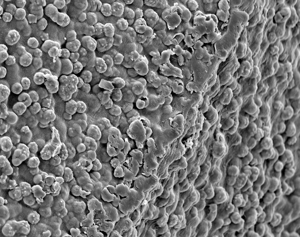 Enterobacter faecalis culture